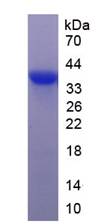 Recombinant Cytochrome C Oxidase Subunit IV Isoform 1 (COX4I1)