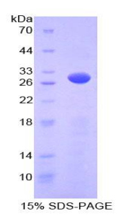 Recombinant Protein Kinase, AMP Activated Gamma 2 (PRKAg2)