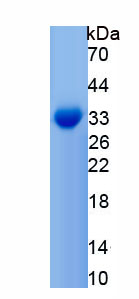 Recombinant Proenkephalin (PENK)