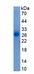 Recombinant Myosin Heavy Chain 7, Cardiac Muscle, Beta (MYH7)