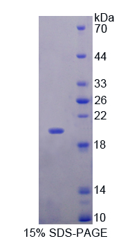 Recombinant Myosin Light Chain 6, Alkali, Smooth Muscle And Non Muscle (MYL6)