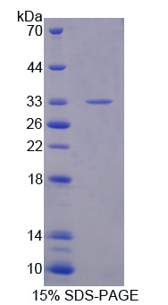 Recombinant Amyloid Beta Precursor Protein Binding Protein A3 (APBA3)