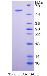 Recombinant Cytochrome P450 26B1 (CYP26B1)