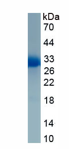 Recombinant Protein Tyrosine Phosphatase, Non Receptor Type 14 (PTPN14)