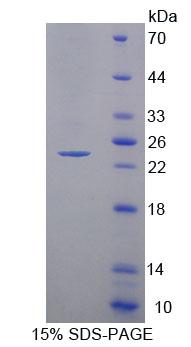 Recombinant Acyl Coenzyme A Dehydrogenase, C2-To-C3 Short Chain (ACADS)