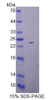 Recombinant Acyl Coenzyme A Dehydrogenase, C2-To-C3 Short Chain (ACADS)