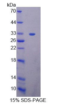 Recombinant High Mobility Group Protein 20B (HMG20B)