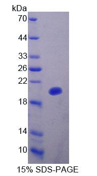 Recombinant Deoxythymidylate Kinase (DTYMK)