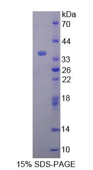 Recombinant Complement Component 8a (C8a)