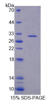 Recombinant Topoisomerase I, Mitochondrial (TOP1MT)