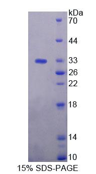 Recombinant Topoisomerase II Binding Protein 1 (TOPBP1)