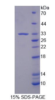 Recombinant Phospholipase C Beta 2 (PLCb2)
