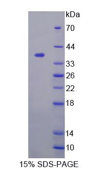 Recombinant Glutamine Fructose-6-Phosphate Transaminase 1 (GFPT1)
