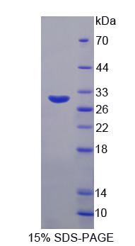 Recombinant Dipeptidyl Peptidase 3 (DPP3)