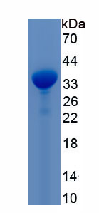 Recombinant Small Nuclear Ribonucleoprotein Polypeptide A (SNRPA)