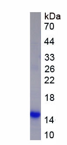Recombinant Sialic Acid Binding Ig Like Lectin 6 (SIGLEC6)
