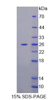 Recombinant 5'-Nucleotidase, Mitochondrial (NT5M)