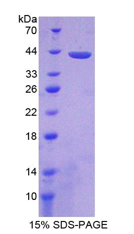 Recombinant Protein Phosphatase 2A Activator, Regulatory Subunit 4 (PPP2R4)