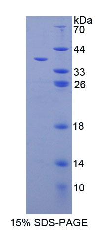 Recombinant Calcineurin Like Phosphoesterase Domain Containing Protein 1 (CPPED1)