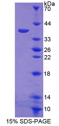 Recombinant Protein Phosphatase 6, Catalytic Subunit (PPP6C)