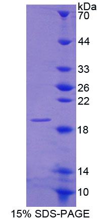 Recombinant Cannabinoid Receptor Interacting Protein 1 (CNRIP1)