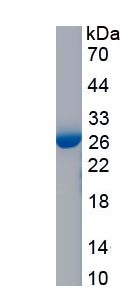 Recombinant Ras Homolog Gene Family, Member B (RHOB)