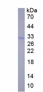 RPE389Hu03.jpg