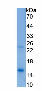 Recombinant Taurine Transporter (TAUT)