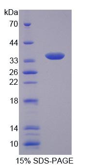 Recombinant Citrate Transporter Protein, Mitochondrial (CTP)