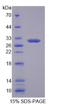 Recombinant Aspartate Glutamate Carrier Isoform 1, Mitochondrial (Agc1)