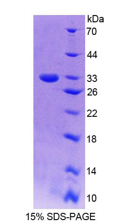 Recombinant Guanylate Binding Protein 6 (GBP6)