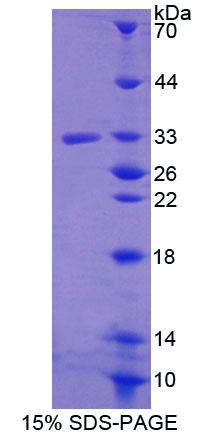 Recombinant Guanylate Binding Protein 5 (GBP5)