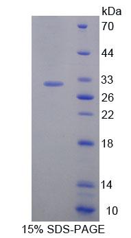 Recombinant Cell Division Cycle Protein 7 (CDC7)