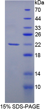 Recombinant Cell Division Cycle Protein 25 (CDC25)
