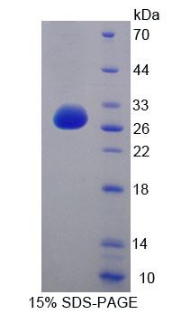 Recombinant Cell Division Cycle Protein 27 (CDC27)