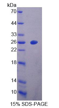 Recombinant Dihydropyrimidinase Like Protein 4 (DPYSL4)