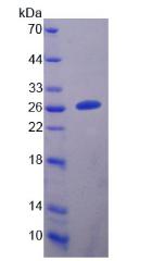 Recombinant Collapsin Response Mediator Protein 5 (CRMP5)