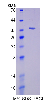 Recombinant SHC-Transforming Protein 1 (SHC1)