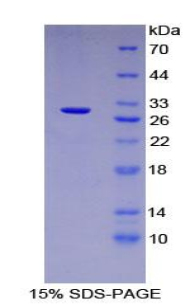 Recombinant Tubulin Beta 6 (TUBb6)