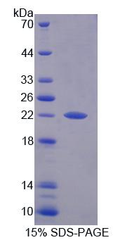 Recombinant Prefoldin Subunit 2 (PFDN2)
