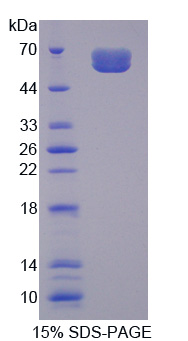 Recombinant Interleukin 20 Receptor Alpha (IL20Ra)