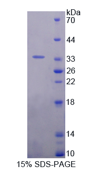 Recombinant Interleukin 20 Receptor Alpha (IL20Ra)