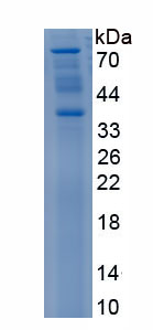 Recombinant Wiskott Aldrich Syndrome Protein Family, Member 2 (WASF2)