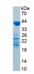 Recombinant Histone Deacetylase 9 (HDAC9)