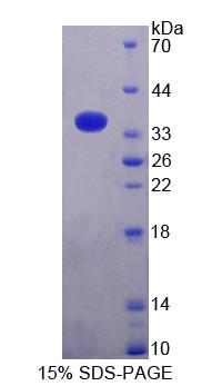 Recombinant Mitochondrial Ribosomal Protein L2 (MRPL2)