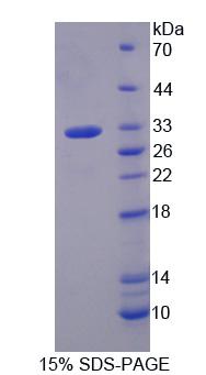 Recombinant G Protein Beta 3 (GNb3)