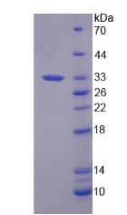 Recombinant Splicing Factor 3B Subunit 1 (SF3B1)