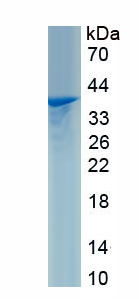 Recombinant Heterogeneous Nuclear Ribonucleoprotein C (HNRPC)