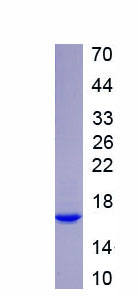 Recombinant Bromodomain Containing Protein 4 (BRD4)
