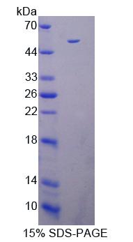 Recombinant Death Associated Protein Kinase 3 (DAPK3)